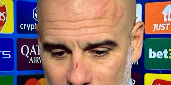 瓜帅头部又现抓痕！率队夺第五座联赛杯引球迷担忧